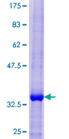 12.5% SDS-PAGE Stained with Coomassie Blue.
